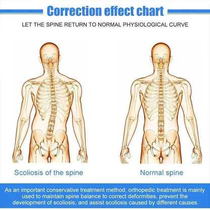 Fixed Aluminum Spinal Straightener Brace